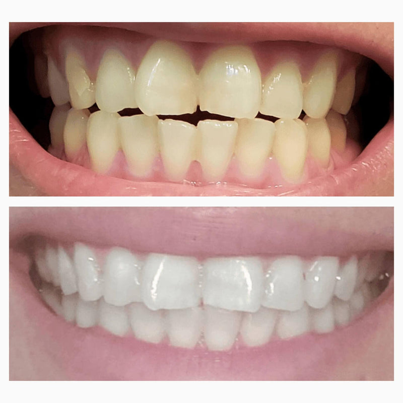 Pasta dental blanqueadora Magic Whitening Booster® en polvo con hidroxiapatita: ¡para espolvorear o sumergir!