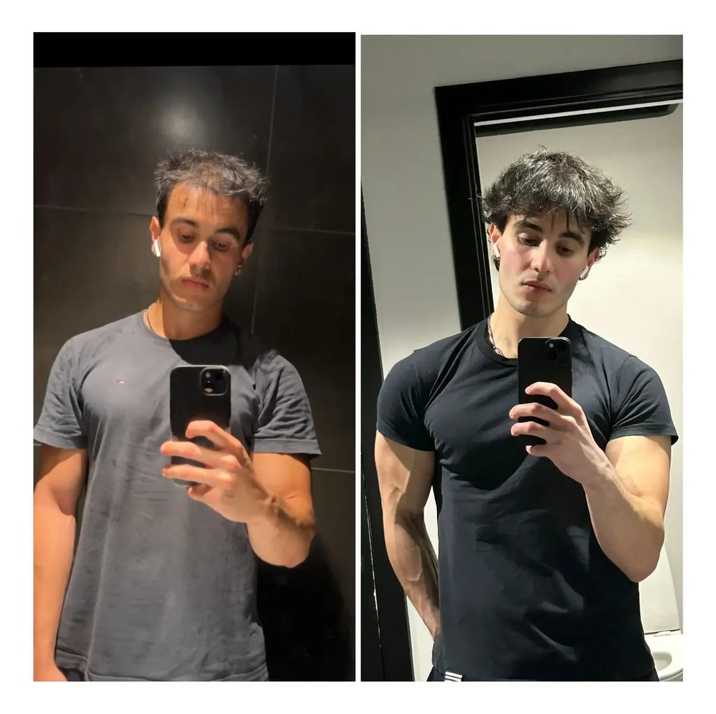 Capixyl Tonic Spray para Hombres – Tratamiento capilar avanzado para detener la caída de cabello y estimular su crecimiento