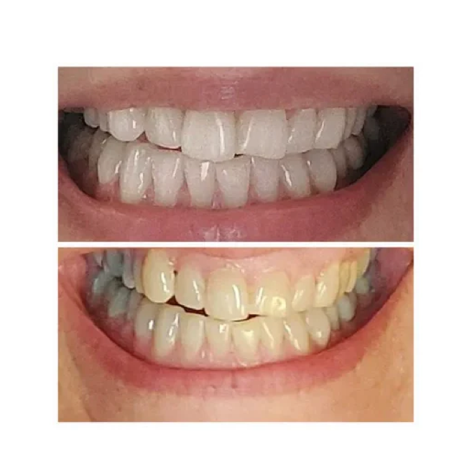 Pasta dental blanqueadora Magic Whitening Booster® en polvo con hidroxiapatita: ¡para espolvorear o sumergir!